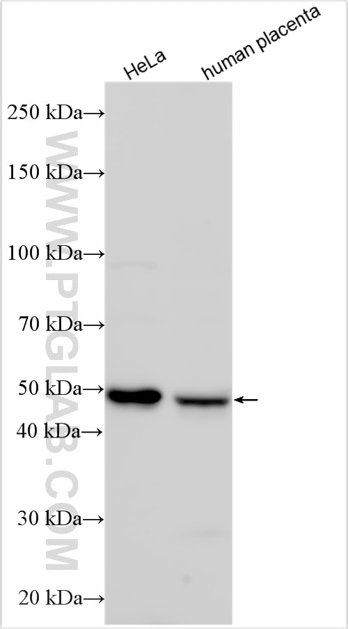 Western Blot (WB) analysis of various lysates using GRINA Polyclonal antibody (20851-1-AP)