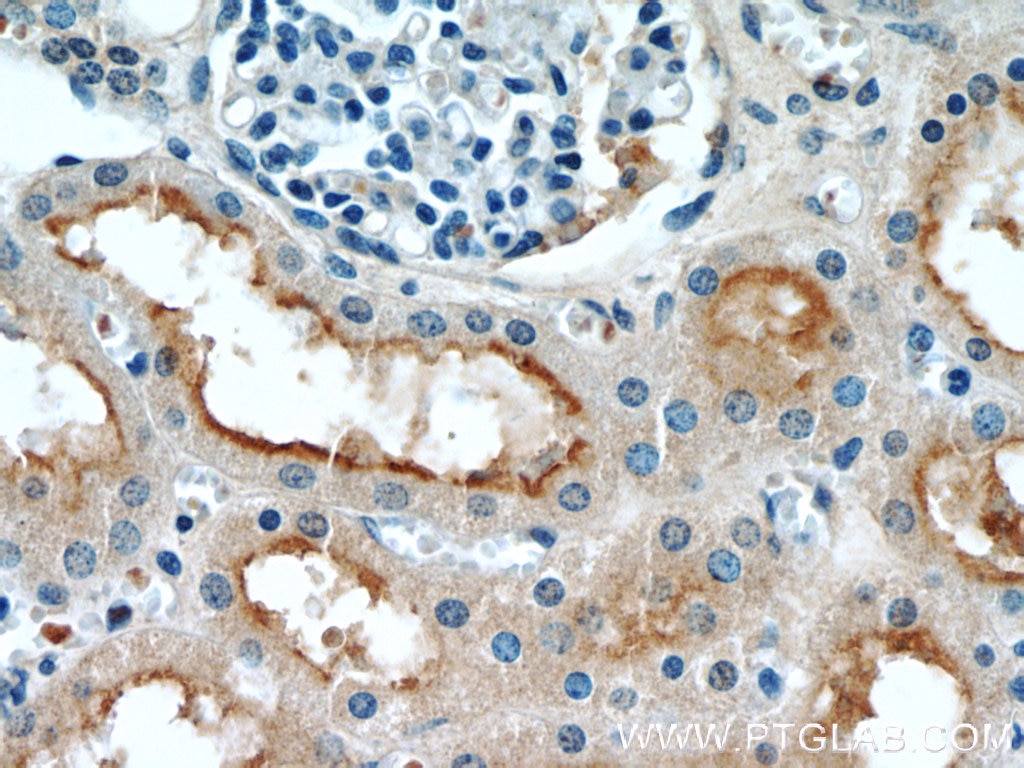 Immunohistochemistry (IHC) staining of human kidney tissue using GRIP1 Polyclonal antibody (22398-1-AP)