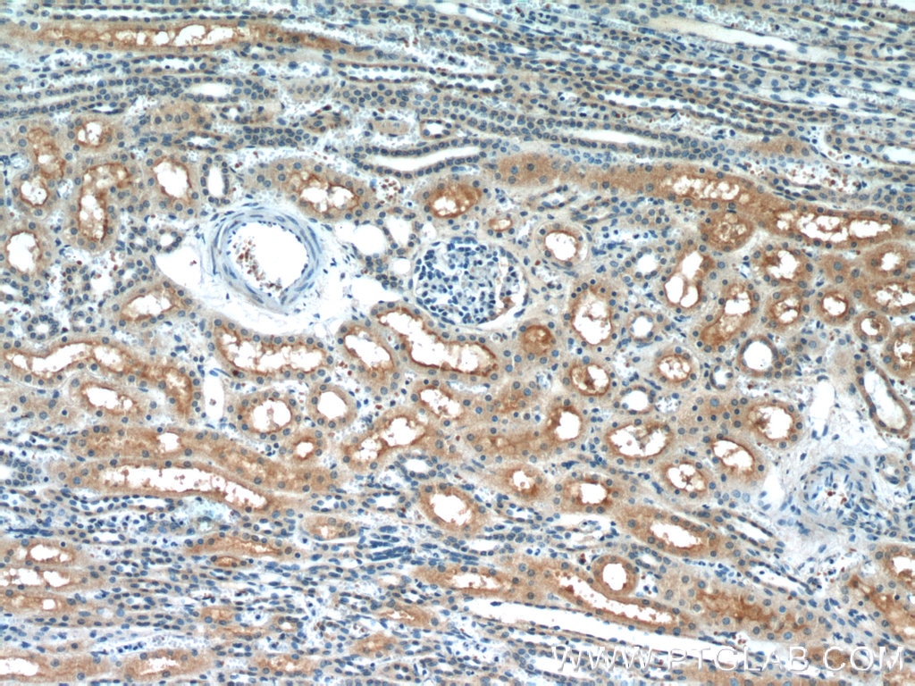 Immunohistochemistry (IHC) staining of human kidney tissue using GRIP1 Polyclonal antibody (22398-1-AP)