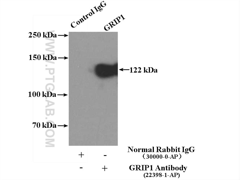 Immunoprecipitation (IP) experiment of mouse brain tissue using GRIP1 Polyclonal antibody (22398-1-AP)