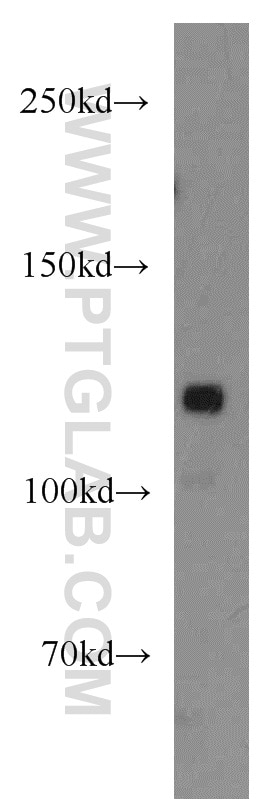 Western Blot (WB) analysis of mouse testis tissue using GRIP1 Polyclonal antibody (22398-1-AP)
