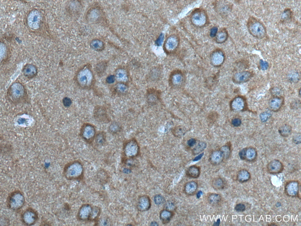 IHC staining of mouse brain using 15806-1-AP