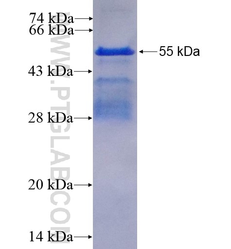 GRIPAP1 fusion protein Ag8540 SDS-PAGE