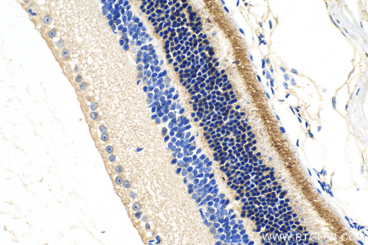 Immunohistochemistry (IHC) staining of mouse eye tissue using GRK1 Polyclonal antibody (24606-1-AP)