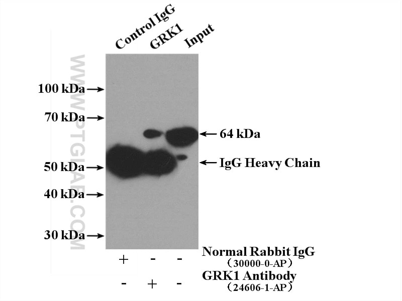 Immunoprecipitation (IP) experiment of Y79 cells using GRK1 Polyclonal antibody (24606-1-AP)