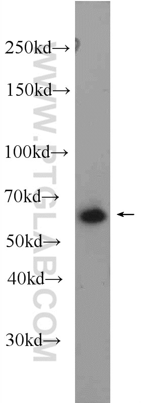 Western Blot (WB) analysis of Y79 cells using GRK1 Polyclonal antibody (24606-1-AP)
