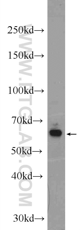 Western Blot (WB) analysis of mouse eye tissue using GRK1 Polyclonal antibody (24606-1-AP)
