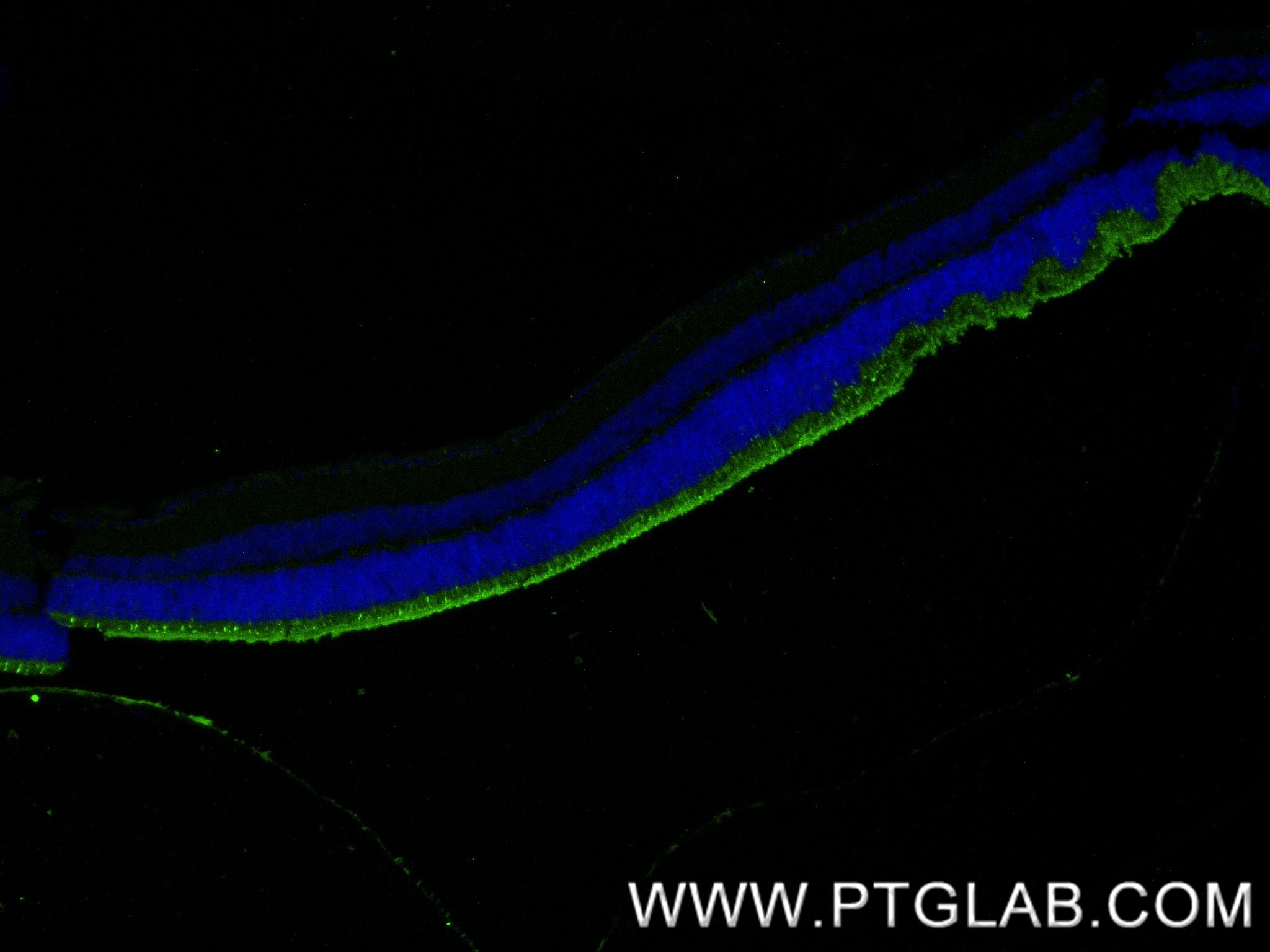 Immunofluorescence (IF) / fluorescent staining of mouse eye tissue using GRK1 Recombinant antibody (85942-1-RR)