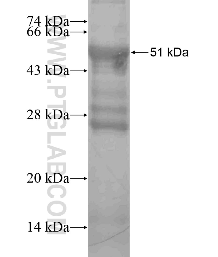 GRK1 fusion protein Ag18063 SDS-PAGE