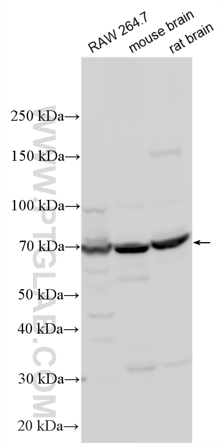 Various lysates were subjected to SDS PAGE followed by western blot with 33470-1-AP (GRK4 antibody) at dilution of 1:1000 incubated at room temperature for 1.5 hours. Western Blot (WB) analysis of various lysates using GRK4 Polyclonal antibody (33470-1-AP)
