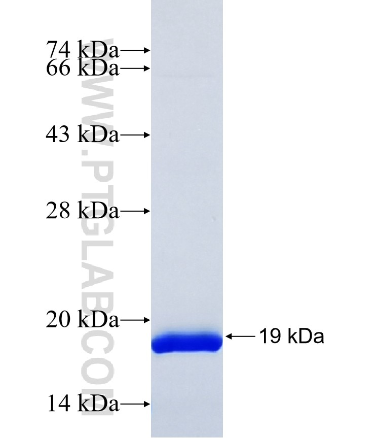 GRK4 fusion protein Ag38107 SDS-PAGE
