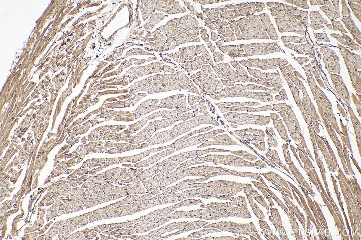Immunohistochemistry (IHC) staining of mouse heart tissue using GRK5 Polyclonal antibody (17032-1-AP)