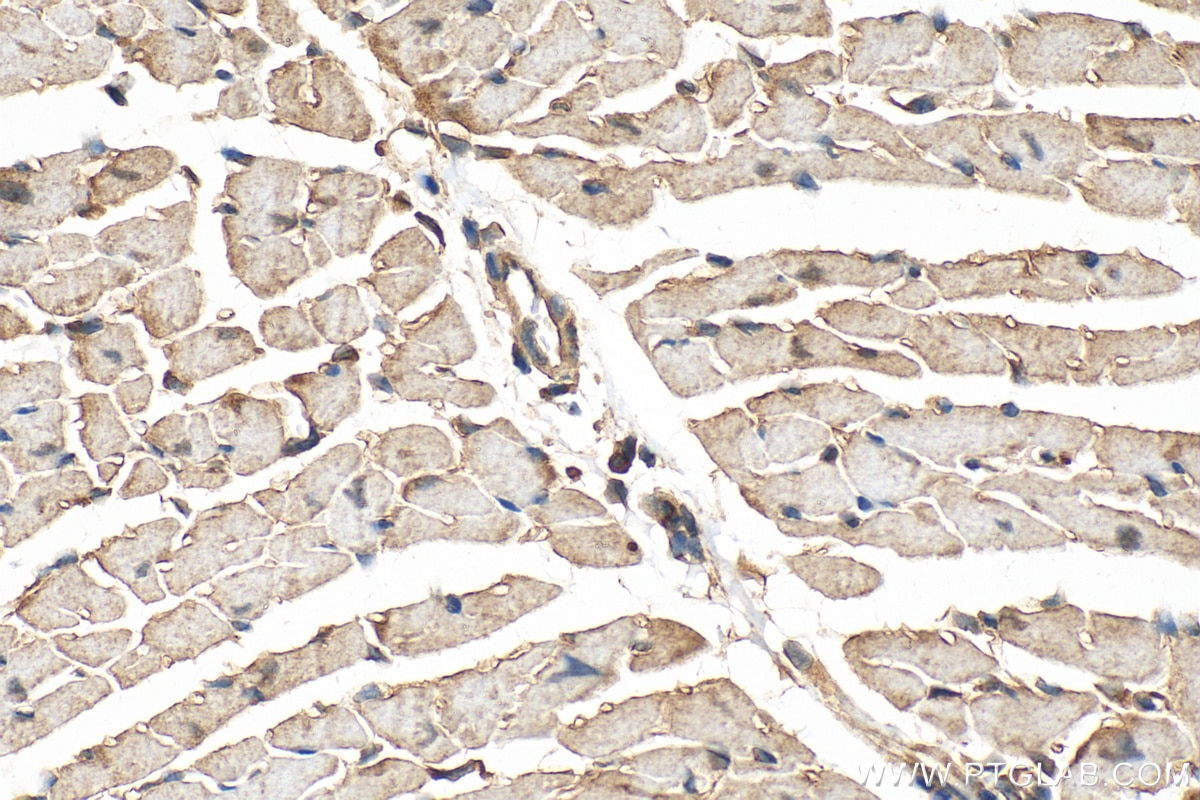 Immunohistochemistry (IHC) staining of mouse heart tissue using GRK5 Polyclonal antibody (17032-1-AP)