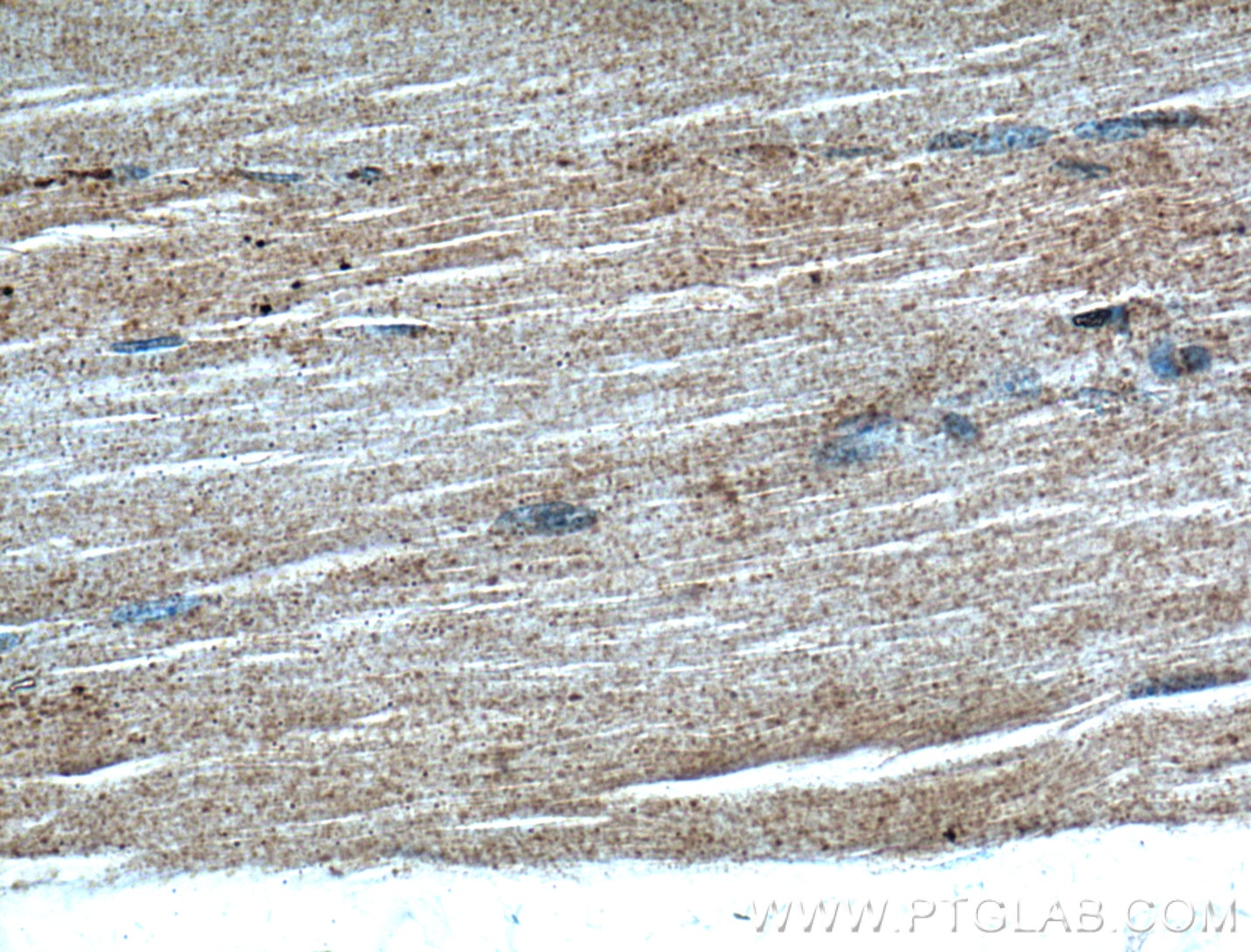 Immunohistochemistry (IHC) staining of human skeletal muscle tissue using GRK5 Polyclonal antibody (17032-1-AP)