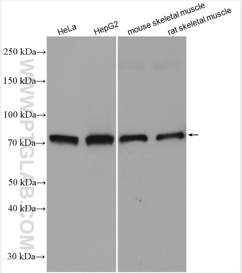 Western Blot (WB) analysis of various lysates using GRK5 Polyclonal antibody (17032-1-AP)