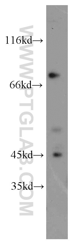 Western Blot (WB) analysis of human skeletal muscle tissue using GRK5 Polyclonal antibody (17032-1-AP)