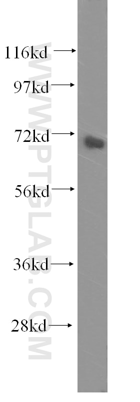 Western Blot (WB) analysis of human skeletal muscle tissue using GRK5 Polyclonal antibody (17032-1-AP)