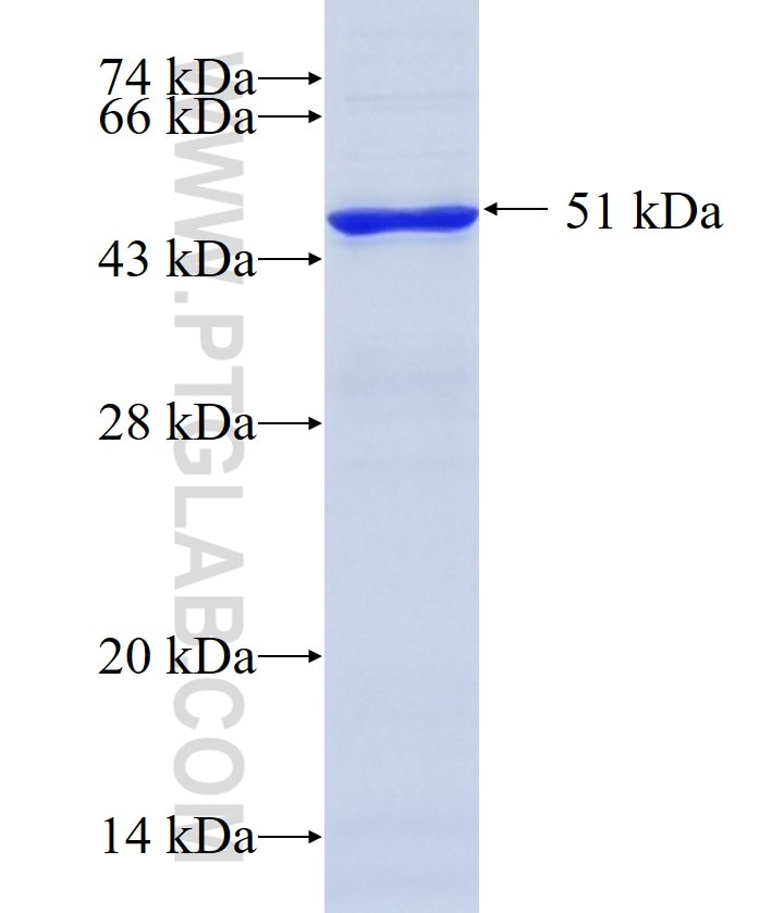 GRK5 fusion protein Ag10511 SDS-PAGE