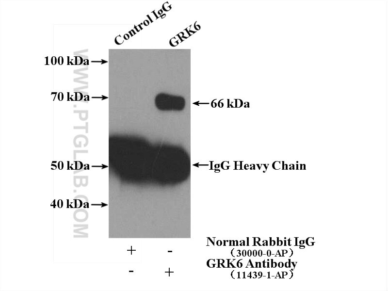 Immunoprecipitation (IP) experiment of HEK-293 cells using GRK6 Polyclonal antibody (11439-1-AP)