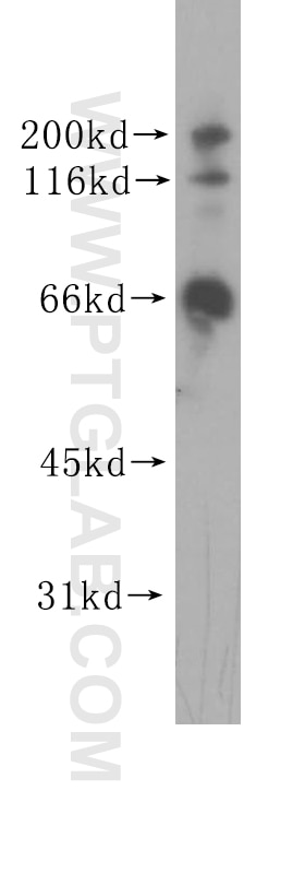 Western Blot (WB) analysis of HEK-293 cells using GRK6 Polyclonal antibody (11439-1-AP)