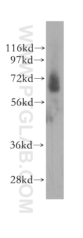 Western Blot (WB) analysis of human kidney tissue using GRK6 Polyclonal antibody (11439-1-AP)