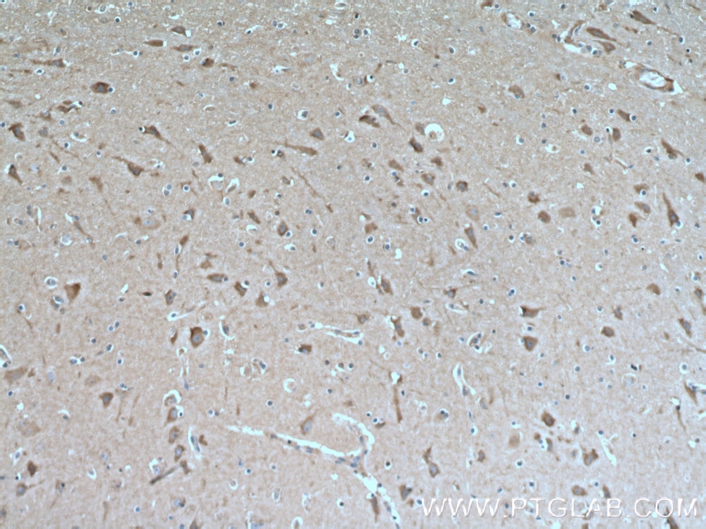 Immunohistochemistry (IHC) staining of human brain tissue using GRLF1 Polyclonal antibody (26789-1-AP)