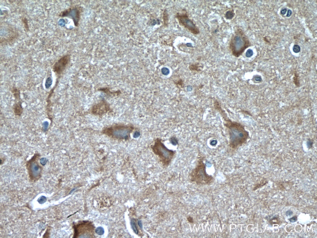 IHC staining of human brain using 26789-1-AP