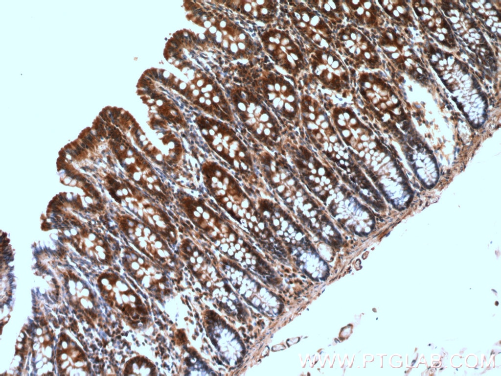 IHC staining of human colon using 26789-1-AP
