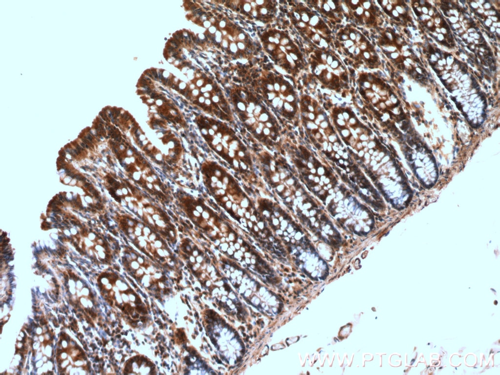 Immunohistochemistry (IHC) staining of human colon tissue using GRLF1 Polyclonal antibody (26789-1-AP)