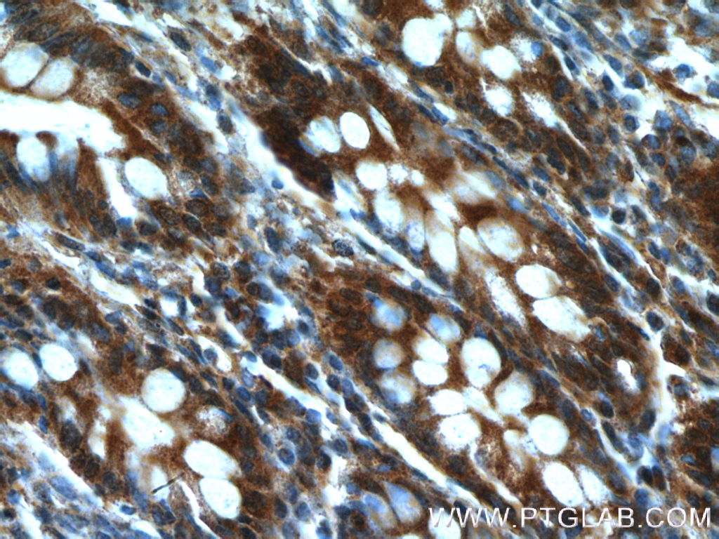 Immunohistochemistry (IHC) staining of human colon tissue using GRLF1 Polyclonal antibody (26789-1-AP)