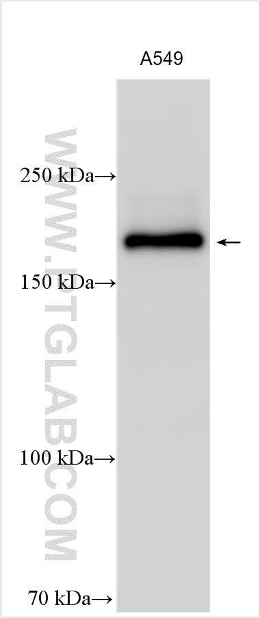 Western Blot (WB) analysis of A549 cells using GRLF1 Polyclonal antibody (26789-1-AP)