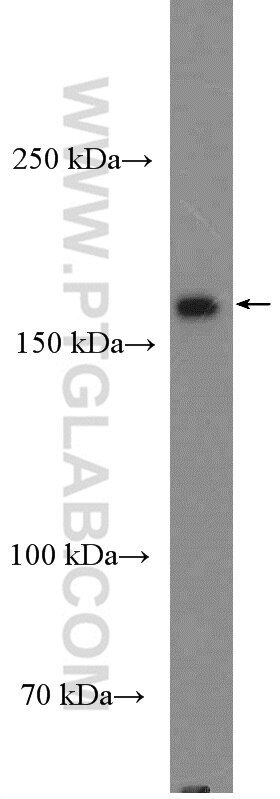 Western Blot (WB) analysis of HeLa cells using GRLF1 Polyclonal antibody (26789-1-AP)