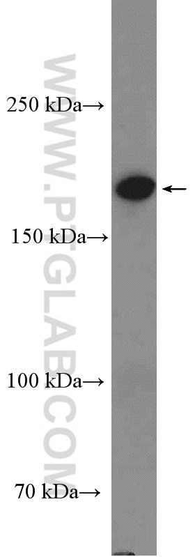 GRLF1 Polyclonal antibody