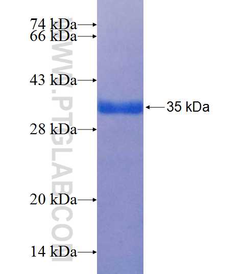 GRLF1 fusion protein Ag25353 SDS-PAGE