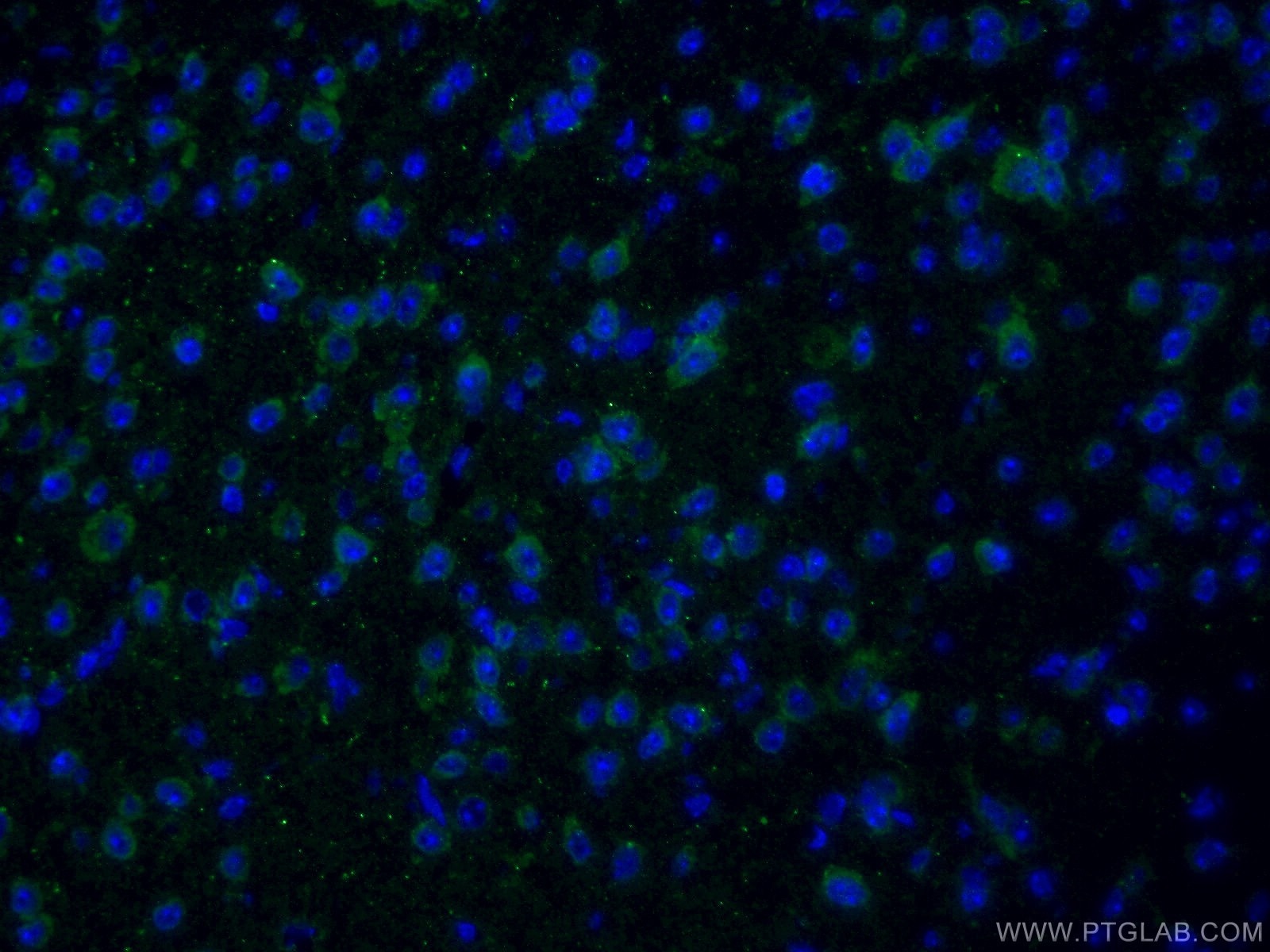 Immunofluorescence (IF) / fluorescent staining of mouse brain tissue using mGluR1 Polyclonal antibody (19955-1-AP)