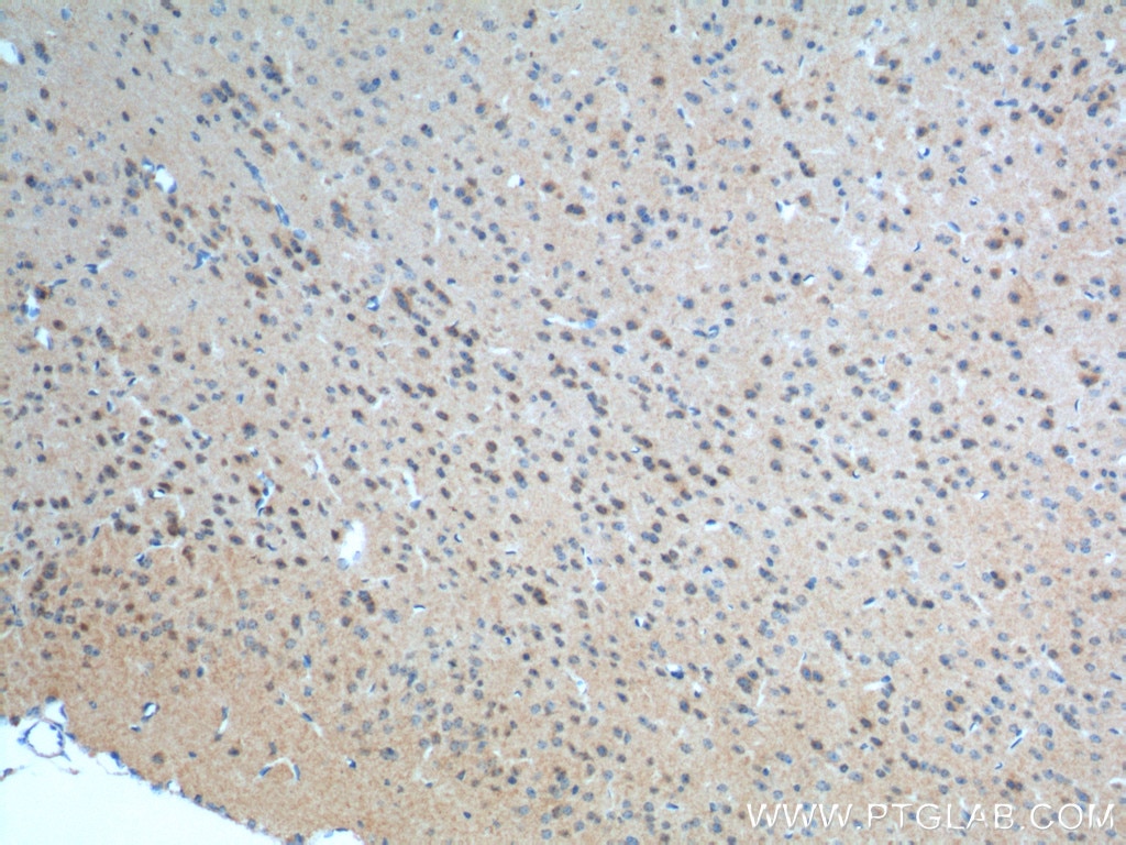 Immunohistochemistry (IHC) staining of mouse brain tissue using mGluR1 Polyclonal antibody (19955-1-AP)