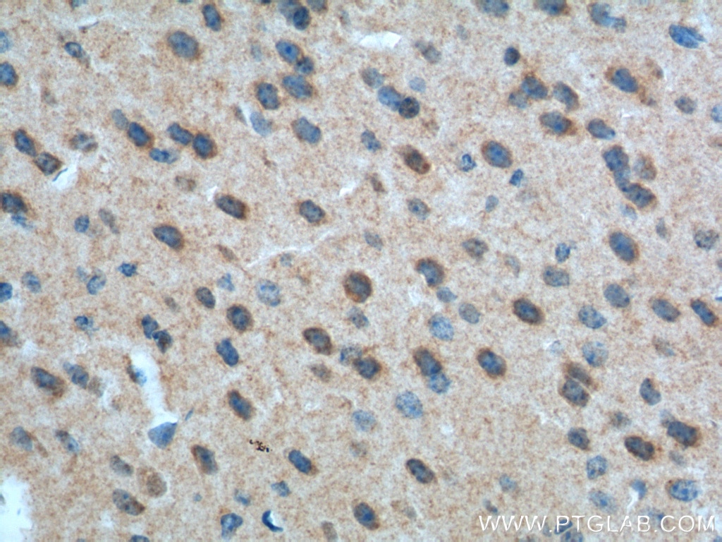 Immunohistochemistry (IHC) staining of mouse brain tissue using mGluR1 Polyclonal antibody (19955-1-AP)