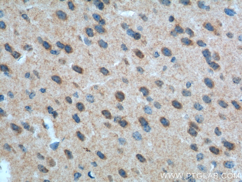 IHC staining of mouse brain using 19955-1-AP