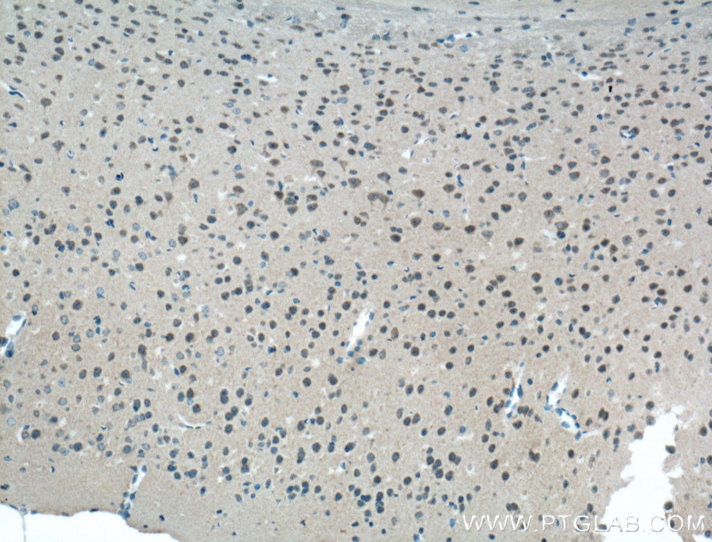 Immunohistochemistry (IHC) staining of mouse brain tissue using mGluR1 Polyclonal antibody (19955-1-AP)