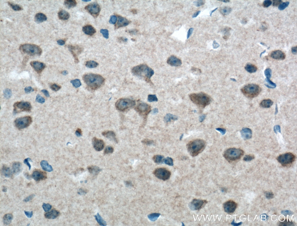 Immunohistochemistry (IHC) staining of mouse brain tissue using mGluR1 Polyclonal antibody (19955-1-AP)