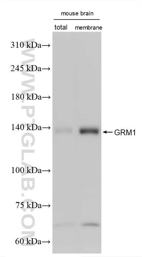 Various lysates were subjected to SDS PAGE followed by western blot with 86280-1-RR (GRM1/mGluR1 antibody) at dilution of 1:2000 incubated at room temperature for 1.5 hours. Western Blot (WB) analysis of mouse brain tissue using GRM1/mGluR1 Recombinant monoclonal antibody (86280-1-RR)