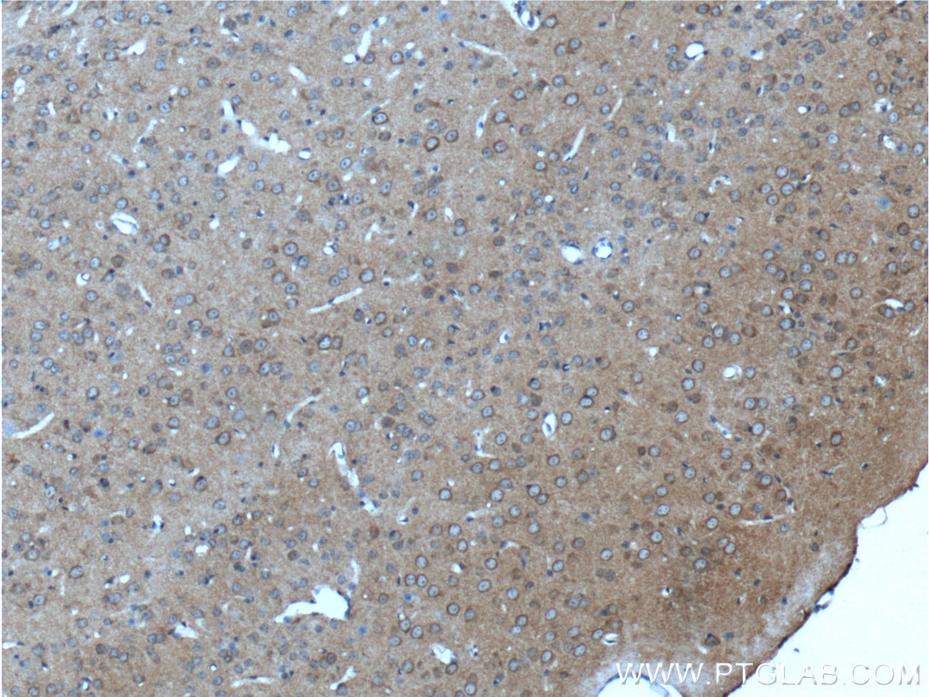 Immunohistochemistry (IHC) staining of mouse brain tissue using mGluR2 Polyclonal antibody (19956-1-AP)