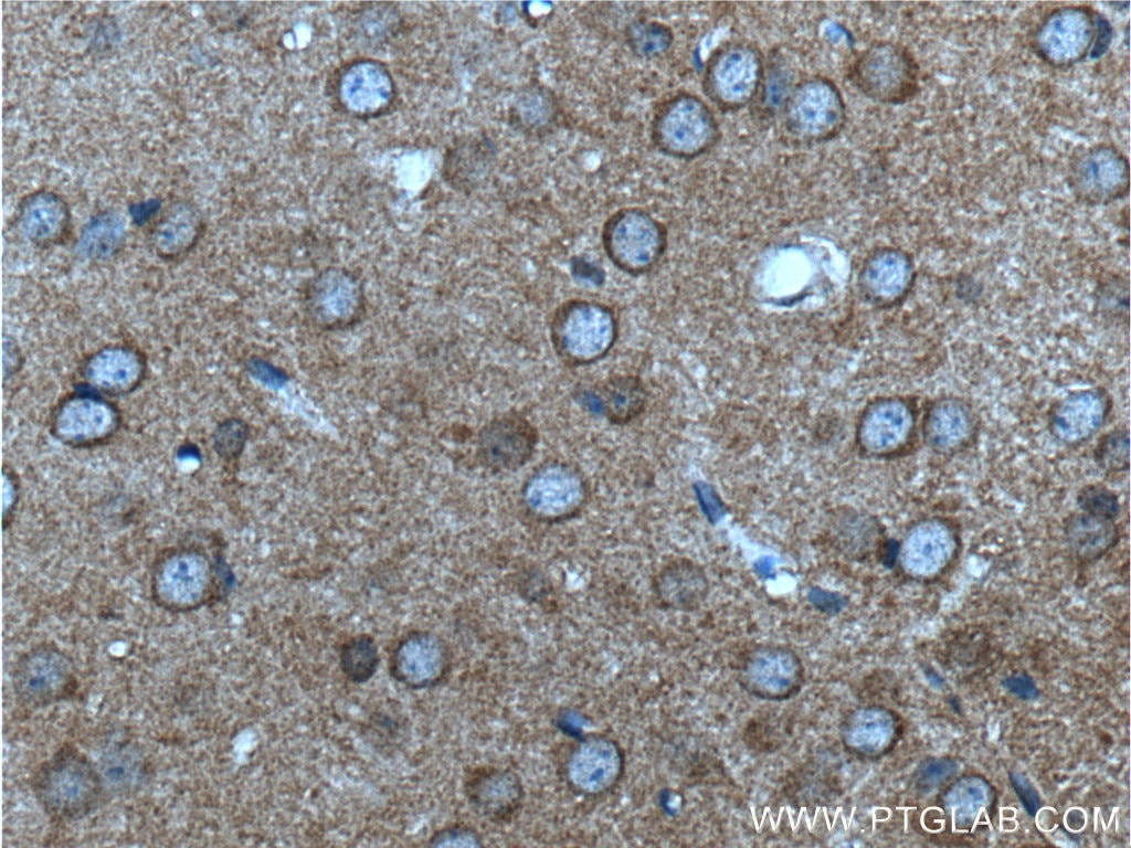 Immunohistochemistry (IHC) staining of mouse brain tissue using mGluR2 Polyclonal antibody (19956-1-AP)