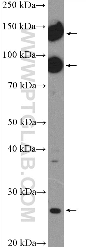 Western Blot (WB) analysis of rat brain tissue using mGluR2 Polyclonal antibody (19956-1-AP)