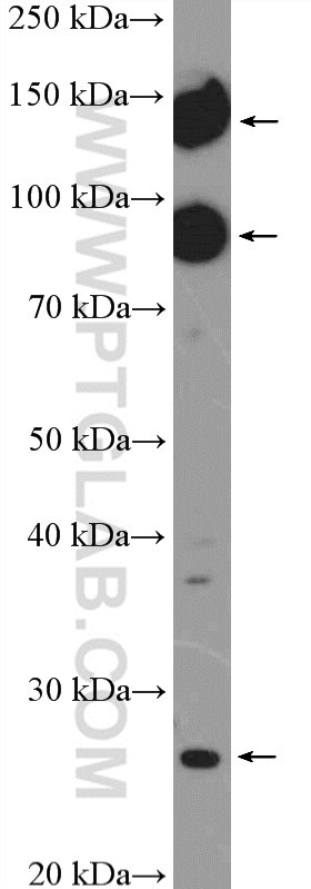 Western Blot (WB) analysis of rat brain tissue using mGluR2 Polyclonal antibody (19956-1-AP)