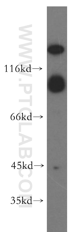 Western Blot (WB) analysis of human brain tissue using mGluR2 Polyclonal antibody (19956-1-AP)