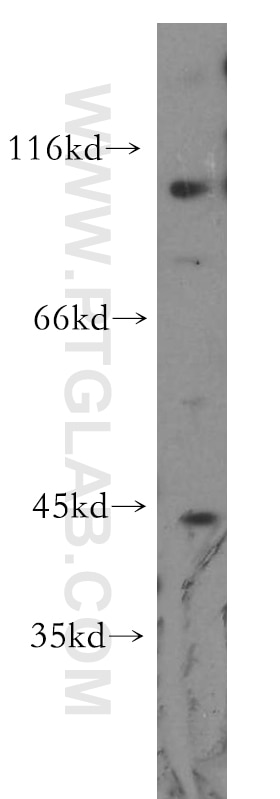 Western Blot (WB) analysis of HeLa cells using mGluR2 Polyclonal antibody (19956-1-AP)