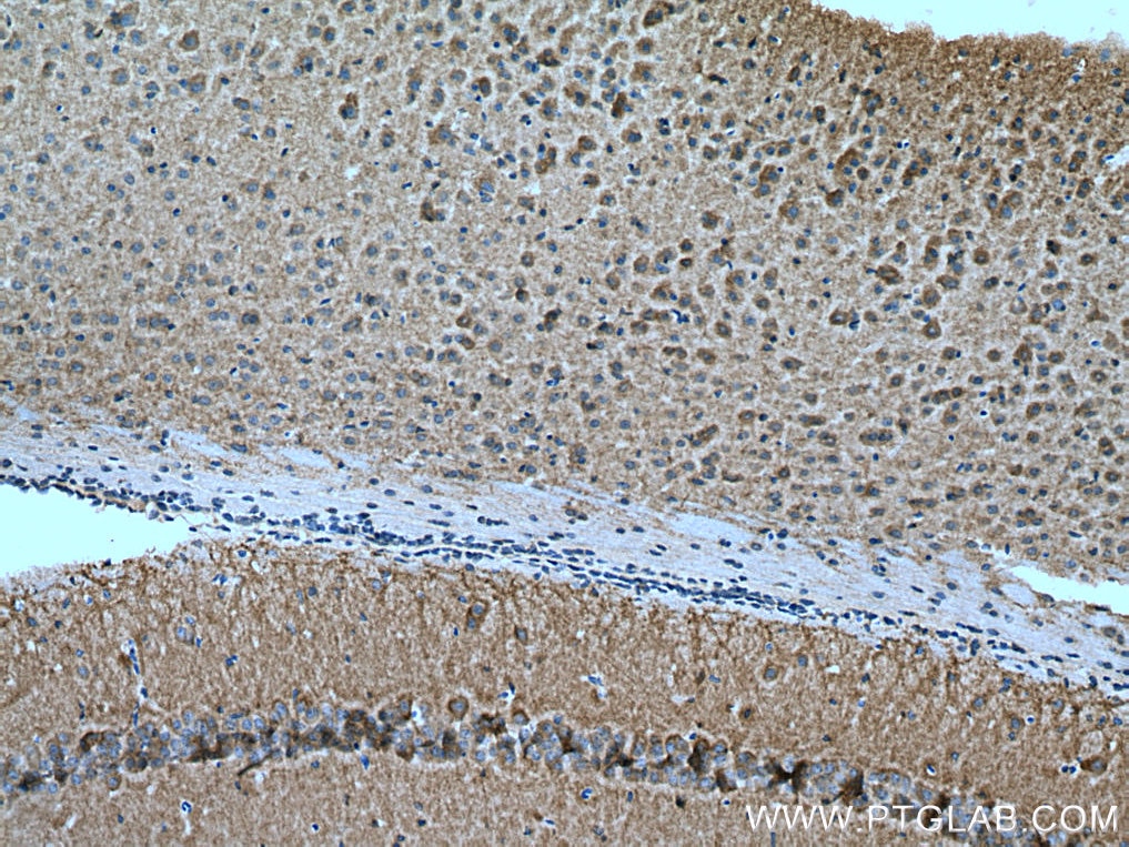 Immunohistochemistry (IHC) staining of mouse brain tissue using GRM5 Polyclonal antibody (28834-1-AP)
