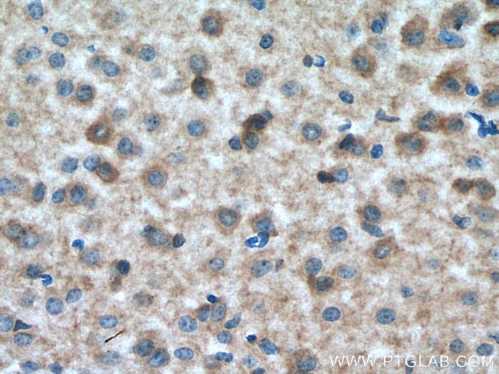Immunohistochemistry (IHC) staining of mouse brain tissue using GRM5 Polyclonal antibody (28834-1-AP)