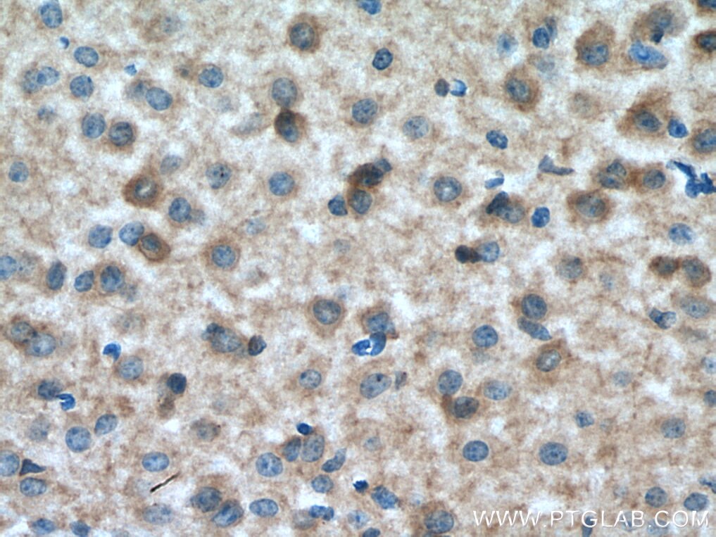 Immunohistochemistry (IHC) staining of mouse brain tissue using GRM5 Polyclonal antibody (28834-1-AP)